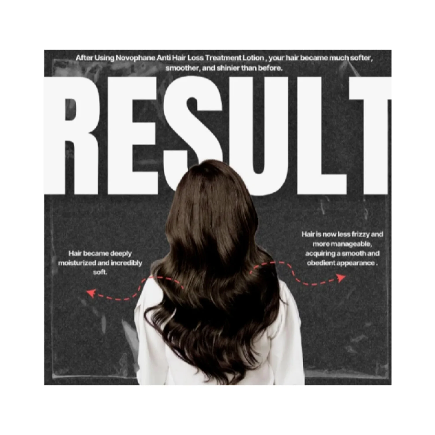 ACM Novophane Reactional Anti Chute Anti Hair Loss Lotion 100 ml