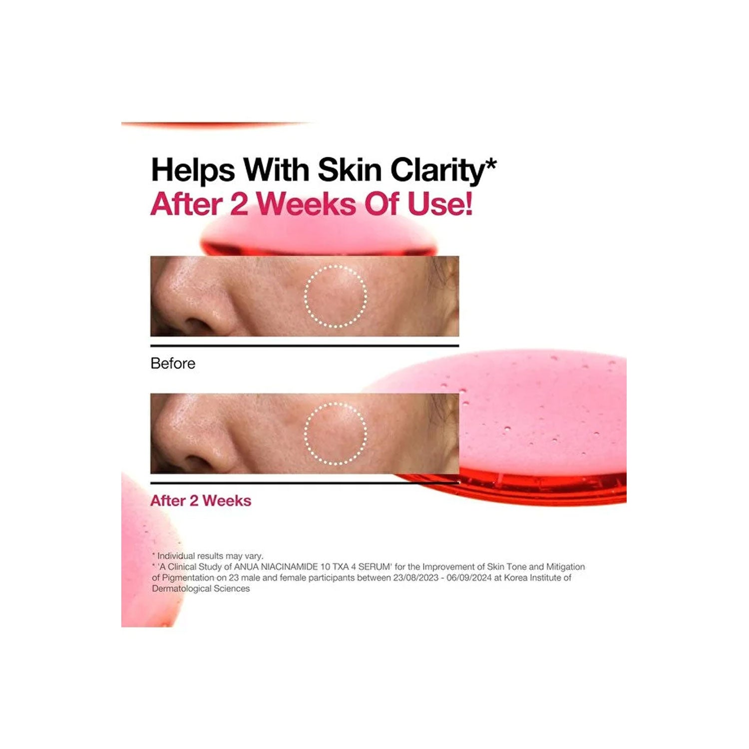 Anua Heartleaf NIACINAMIDE 10% + TXA 4% DARK SPOT REMOVING SERUM 30mL