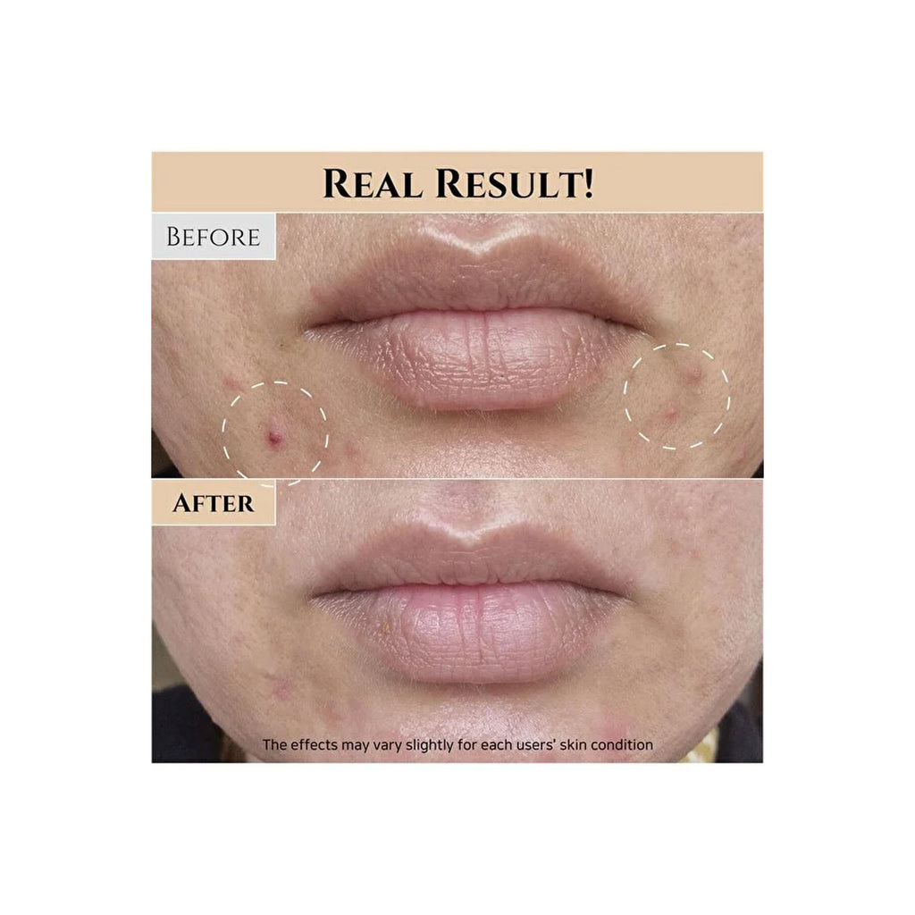 Beauty of Joseon Glow Replenishing Rice Facial Sebum Toner for Oily Combination and Dry Skin