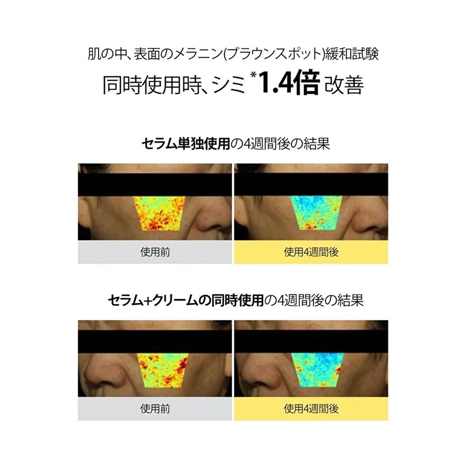 Goodal Goodal Green Tangerine Vitamin-C Dark Spot Serum for Sensitive Skin | Niacinamide-40ml/1.35fl.oz