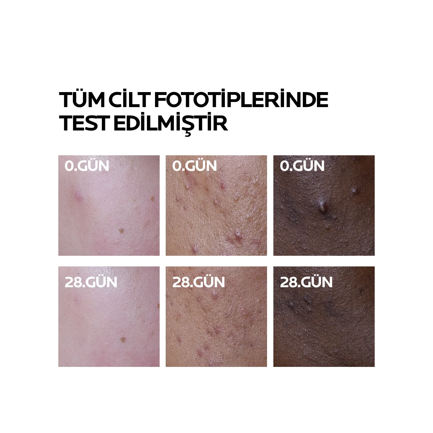 La Roche Posay Effaclar Duo+M 40ml Skin Care Cream - Oily and Acne Prone